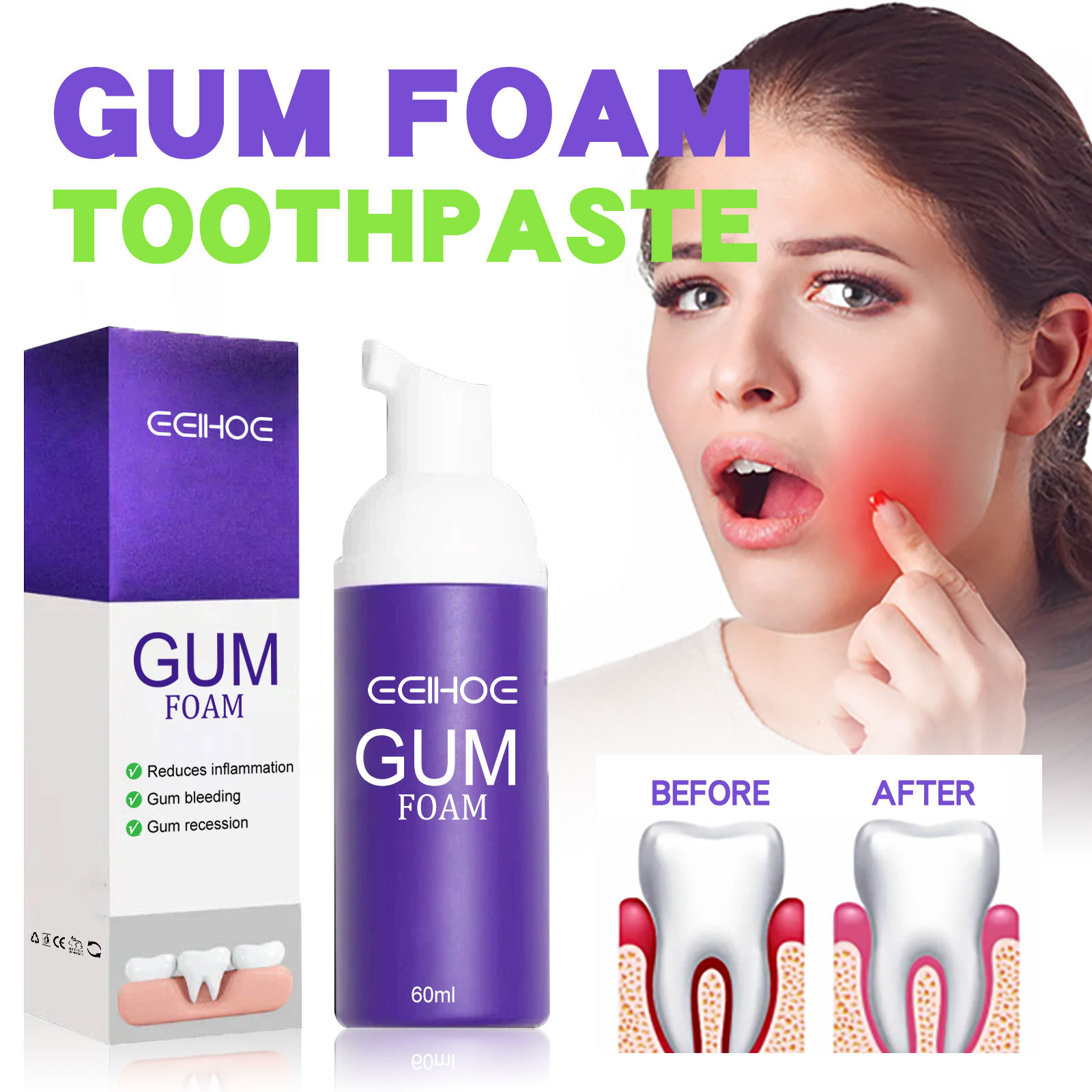 Teeth Whitening Best - Mousse de blanchiment des dents V34,