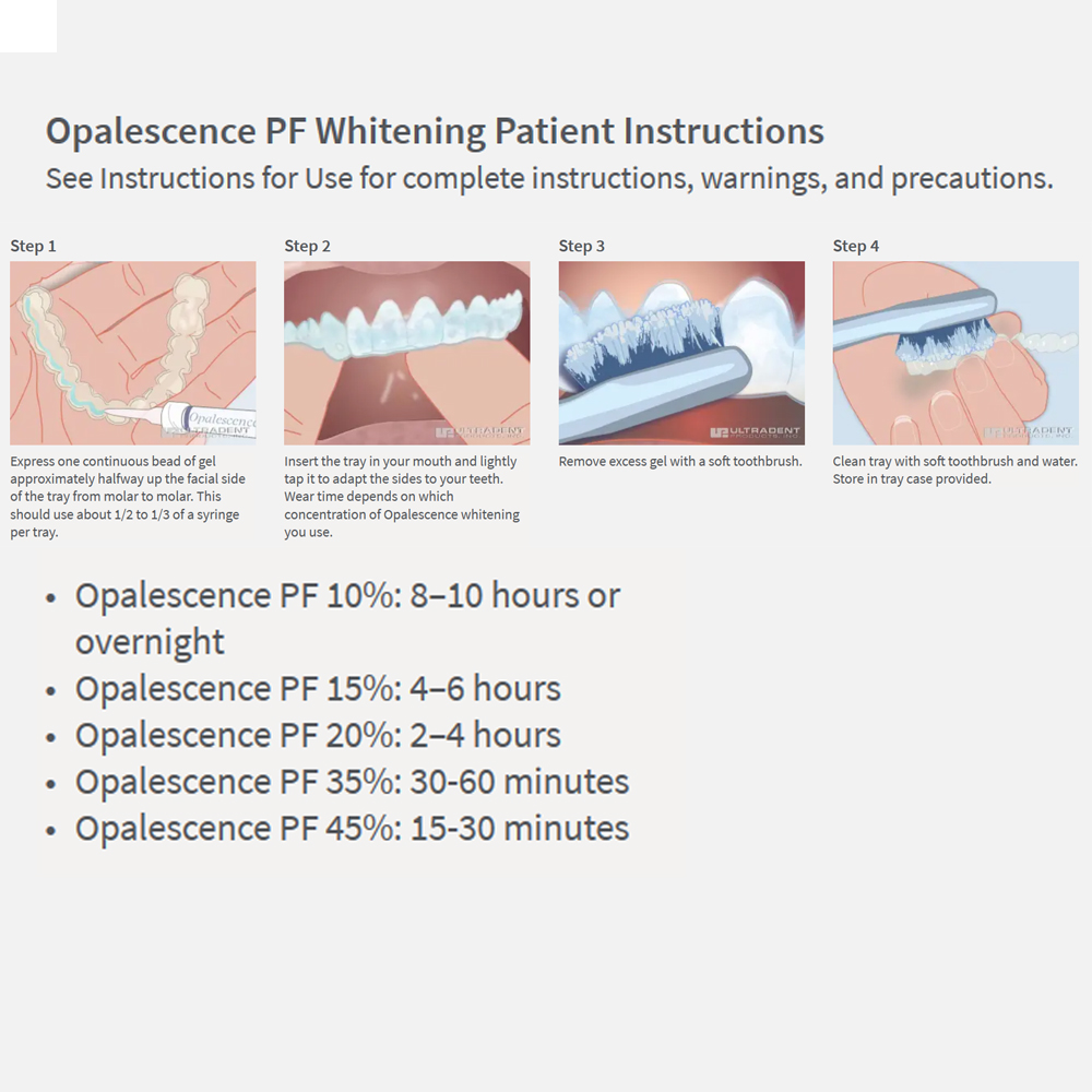 Opalwisdom-Kit de Blanchiment  - Teeth Whitening Doctor avis et prix