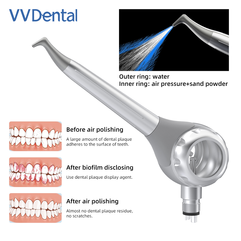 Pistolet de sablage dentaire V - Teeth Whitening Dental avis et prix