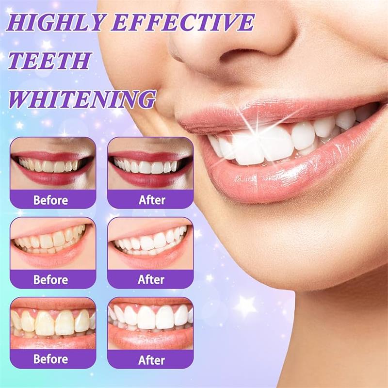 Mousse dentifrice blanchissant - Teeth Whitening Best avis et prix