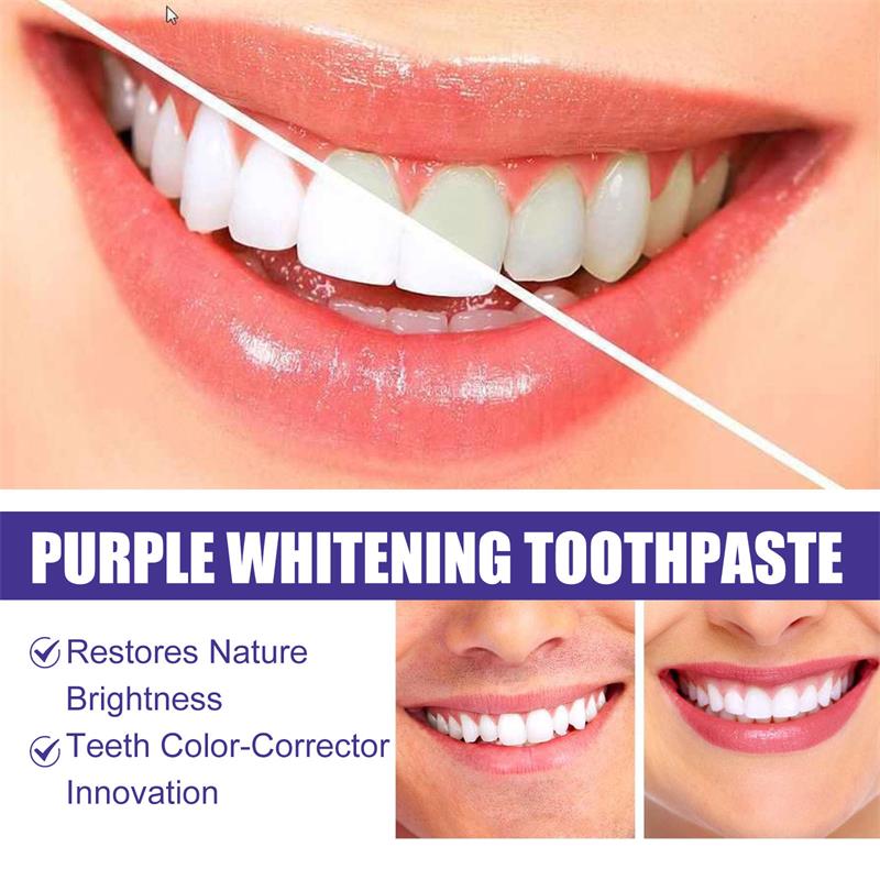Mousse dentifrice blanchissant - Teeth Whitening Best avis et prix