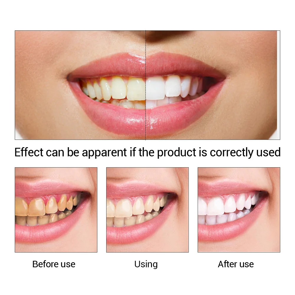 FTEENPLY poudre d'essence de b - Teeth Whitening Ulta avis et prix
