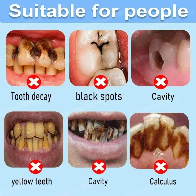 Dentifrice anti-caries : répar - Teeth Whitening Best avis et prix