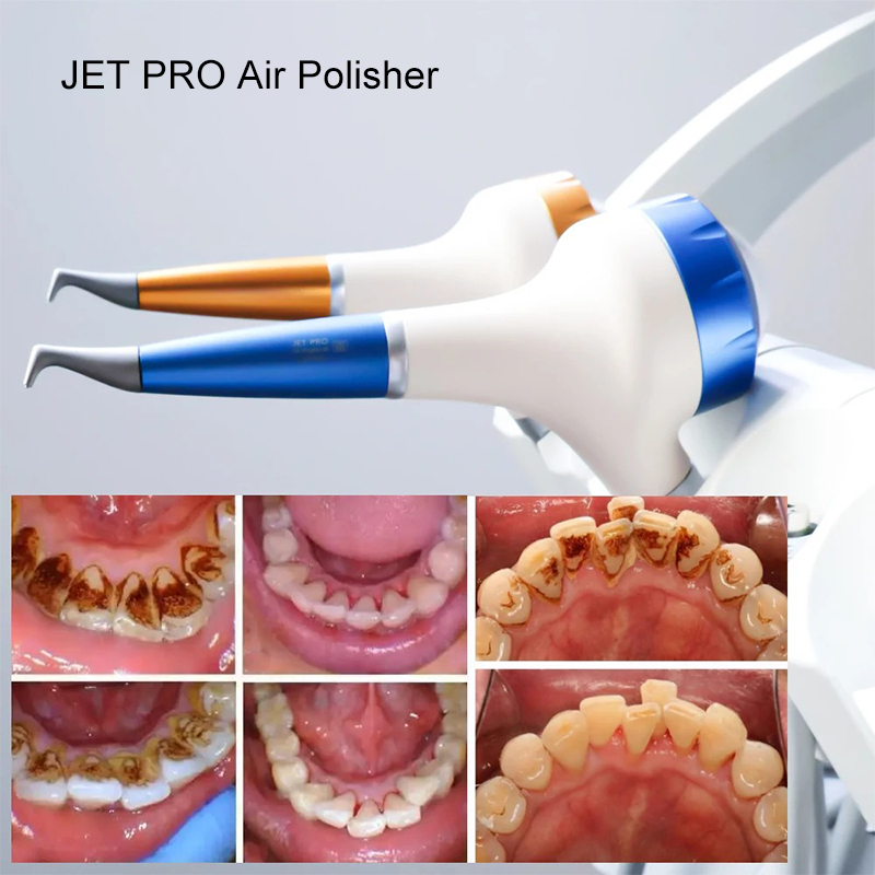 VV Dental Air Polishing Prophy - Teeth Whitening Dental avis et prix