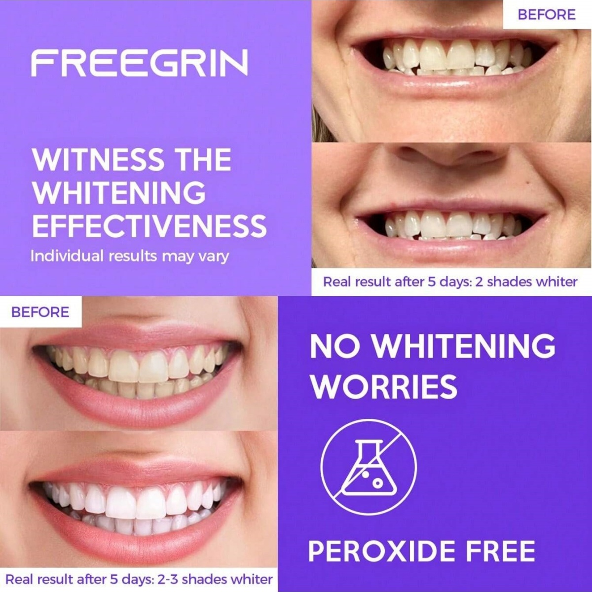 Autocollants de blanchiment de - Teeth Whitening Doctor avis et prix