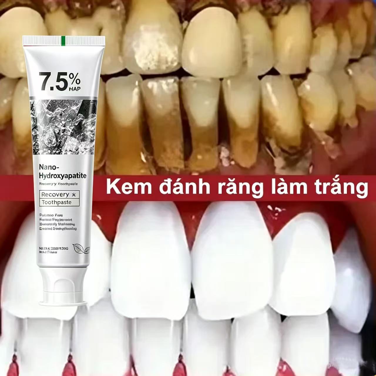 Dentifrice blanchissant probio - Teeth Whitening Best avis et prix