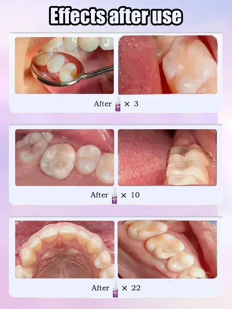 Nettoyage des dents dentifrice - Teeth Whitening Best avis et prix