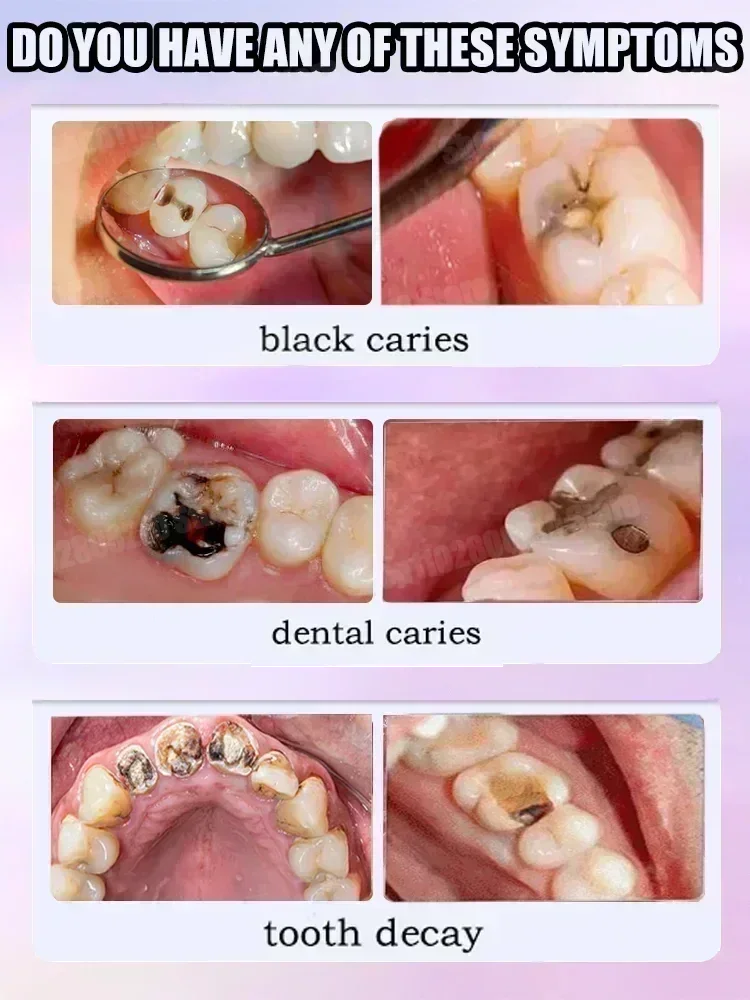 Nettoyage des dents dentifrice - Teeth Whitening Best avis et prix